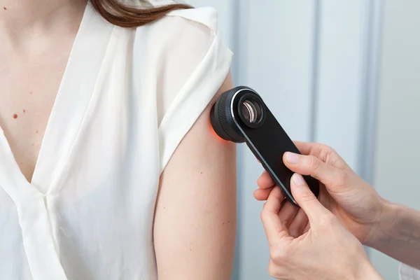 Doctor examining birthmarks and moles on a female patient — Stock Photo, Image