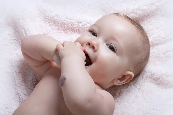 Schattige babymeisje met hemangioom op haar arm — Stockfoto