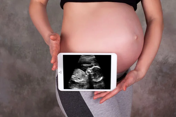 Pregnant belly and ultrasound photo — Stock Photo, Image