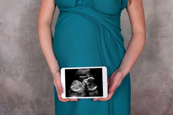 Buik van een zwangere vrouw in blauwe jurk — Stockfoto