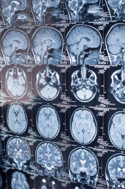 İnsan beyninin Mr'ı teşhis