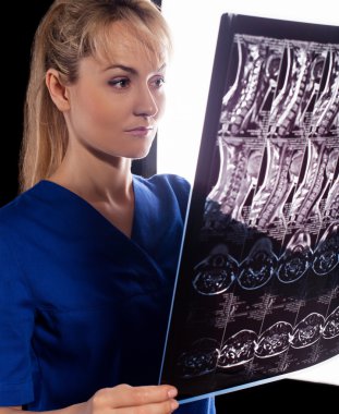 Doktor servikal MRG ile