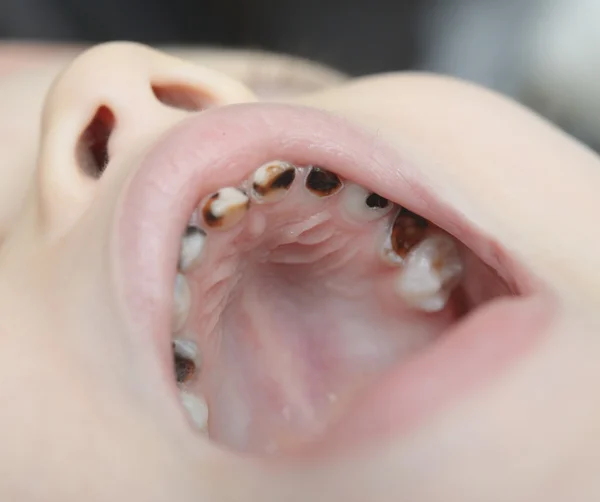 Baby mit offenem Mund — Stockfoto