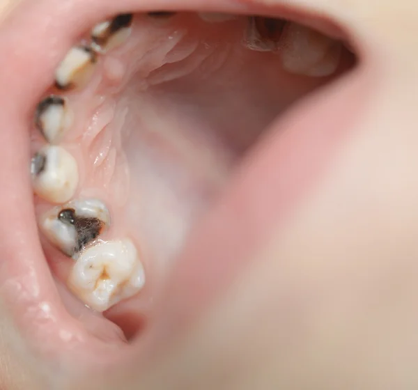 Baby bocca aperta — Foto Stock