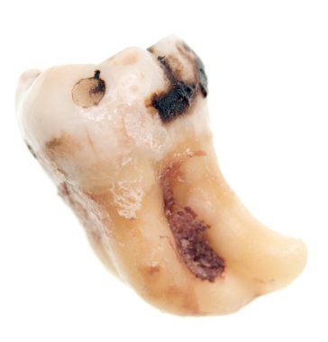 Beyaz arkaplanda yirmilik diş izole