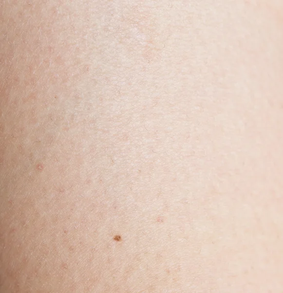 Human skin — Stock Photo, Image