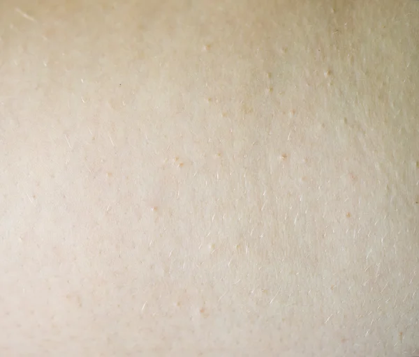 Human skin — Stock Photo, Image