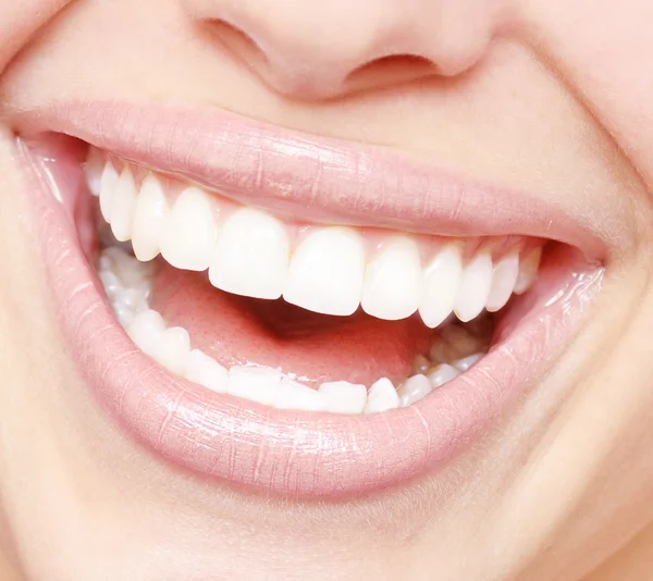 Kadın sağlıklı dişler — Stok fotoğraf
