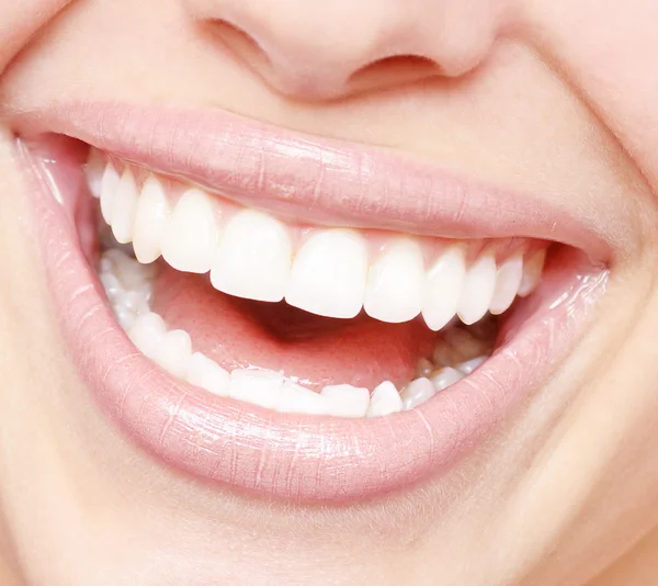 Dientes sanos de la mujer —  Fotos de Stock