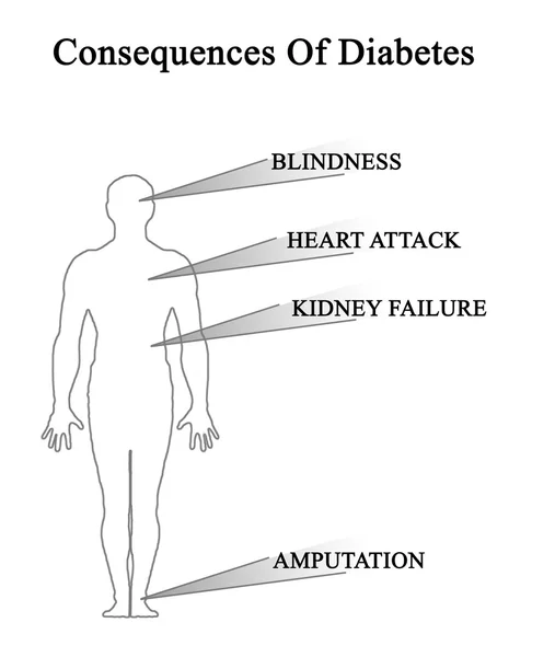 Diagrama de las consecuencias de la diabetes — Foto de Stock