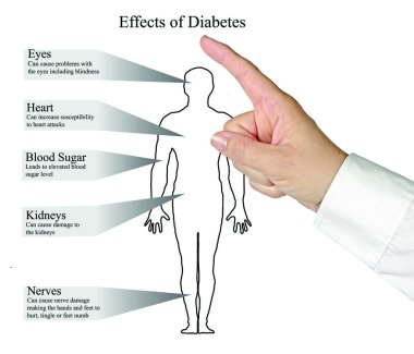Diyabet etkileri diyagramı