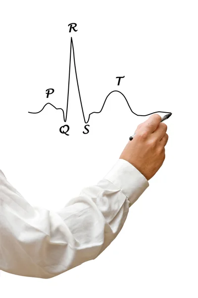 EKG grafiği çizim — Stok fotoğraf