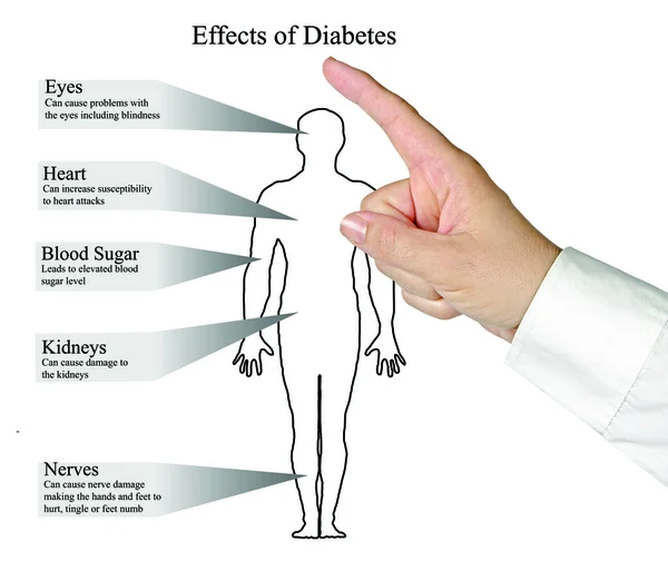 Diagrama de los efectos de la diabetes — Foto de Stock