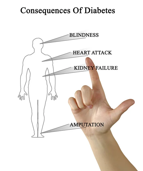 Diagrama de las consecuencias de la diabetes —  Fotos de Stock