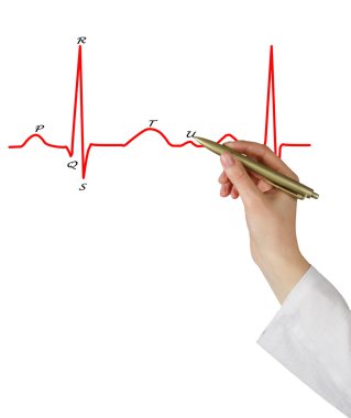 EKG grafik sunumunu