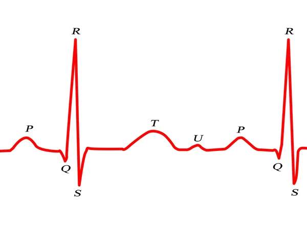 Prezentacji wykres EKG — Zdjęcie stockowe