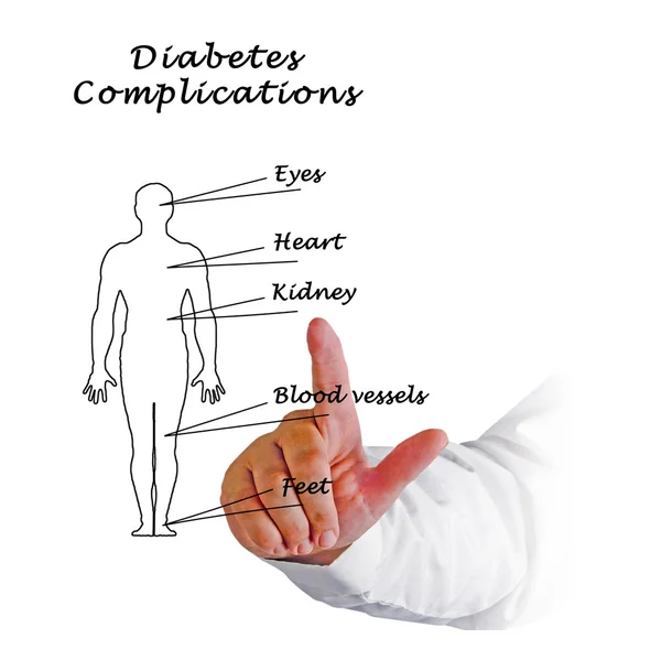 Diyabet komplikasyonları diyagramı — Stok fotoğraf