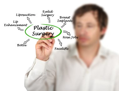 Plastik cerrahi diyagramı
