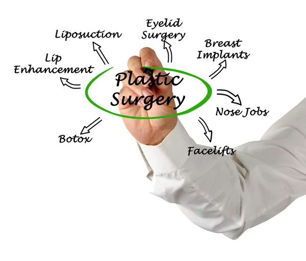 Diagrama de cirurgia plástica — Fotografia de Stock