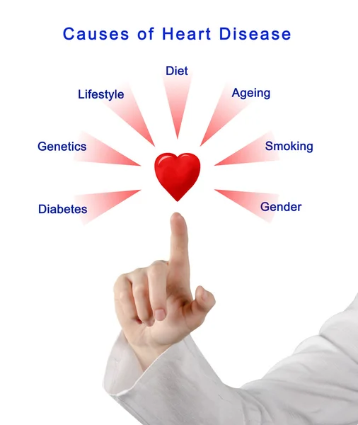 Diagram of Causes of Heart Disease — Stock Photo, Image