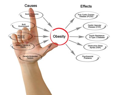 Diagram of Obesity: causes and effects clipart