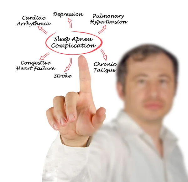 Uyku apnesi komplikasyonu — Stok fotoğraf