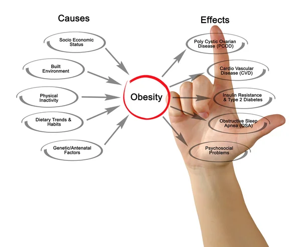 Obesitas: oorzaken en gevolgen — Stockfoto