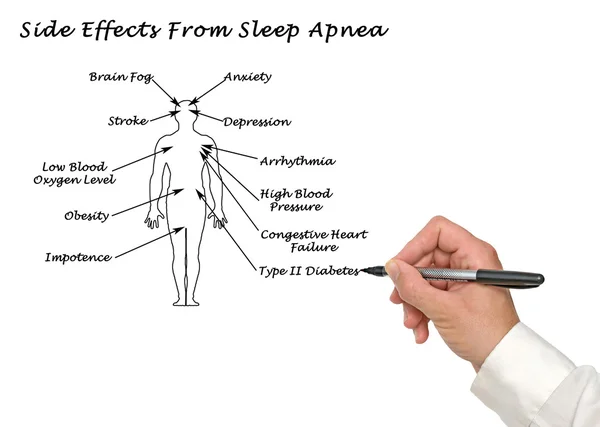 Efectos secundarios de la apnea del sueño — Foto de Stock