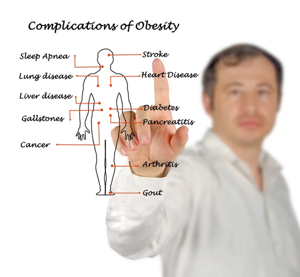 Diagramm der Komplikationen der Fettleibigkeit — Stockfoto
