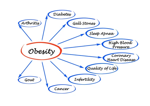 Presentación de Diagrama de Obesidad — Foto de Stock