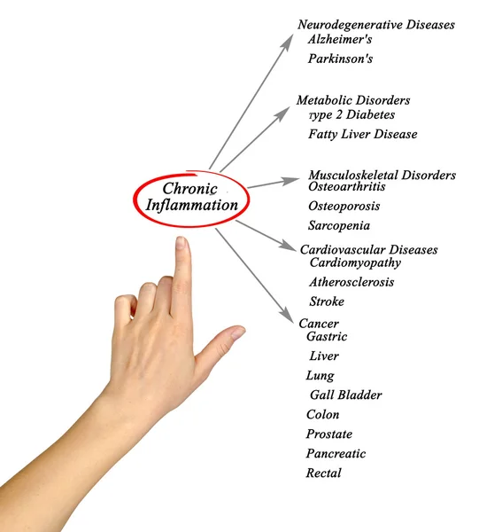 Diagrama inflamației cronice — Fotografie, imagine de stoc