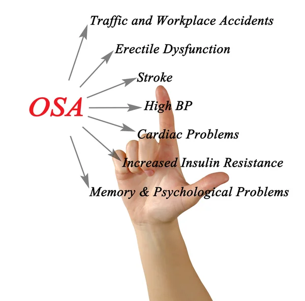 Diagrama de la apnea obstructiva del sueño — Foto de Stock