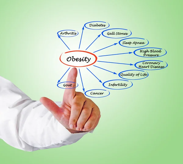 Presentazione del diagramma dell'obesità — Foto Stock