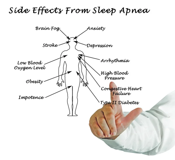 Побочные эффекты от апноэ сна — стоковое фото