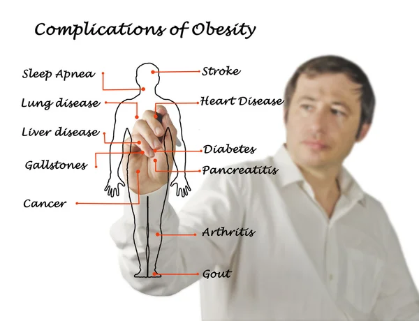 Diagramm der Komplikationen der Fettleibigkeit — Stockfoto