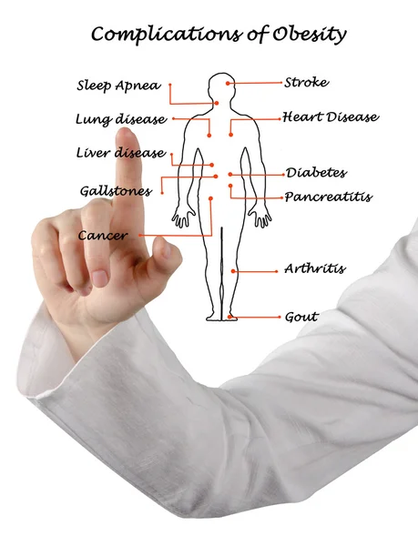 Diagram of Complications of Obesity — Stock Photo, Image