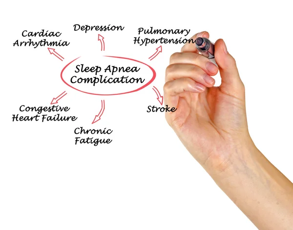 Diagram of Complication Of Sleep Apnea — Stock Photo, Image