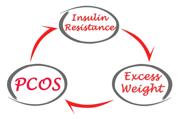 Zyklus Des Polyzystischen Ovar Syndroms Pcos — Stockfoto