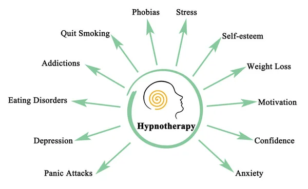 Hipnoterapi Uygulaması — Stok fotoğraf