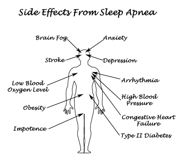 Effets de la sirène de l'apnée du sommeil — Photo