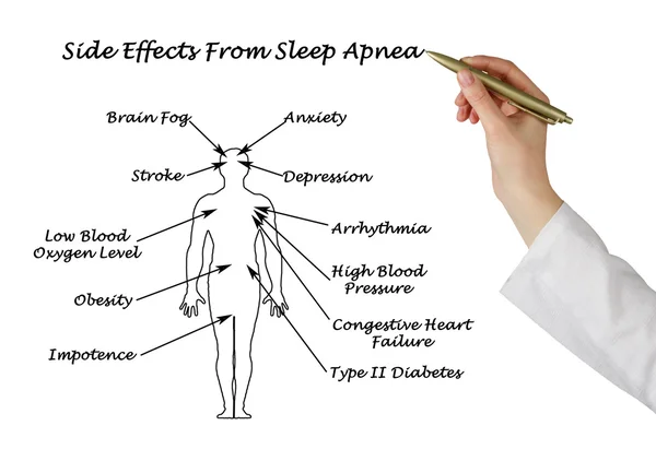 赛扶从睡眠呼吸暂停的影响 — 图库照片