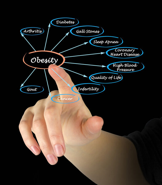 Диаграмма ожирения
