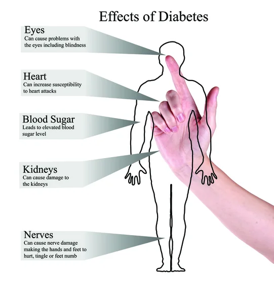 Effects of diabetes — Stock Photo, Image