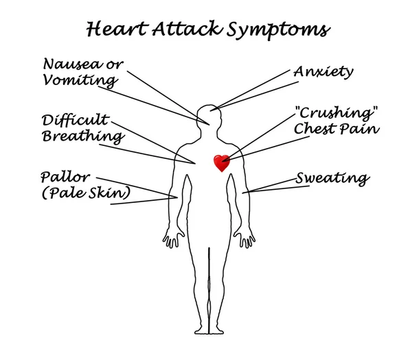 Příznaky srdeční infarkt — Stock fotografie