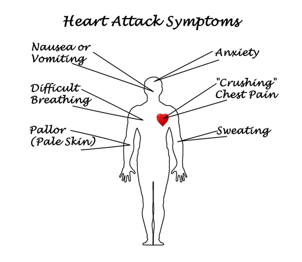 Kalp krizi belirtileri — Stok fotoğraf