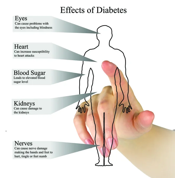 Επιπτώσεις του διαβήτη — Φωτογραφία Αρχείου