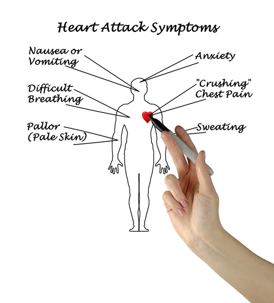 Ataque cardíaco Síntomas — Foto de Stock