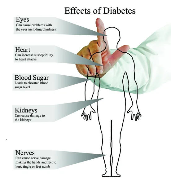 Воздействие диабета — стоковое фото
