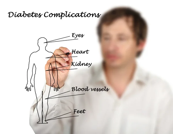 Complicaciones de diabetes —  Fotos de Stock
