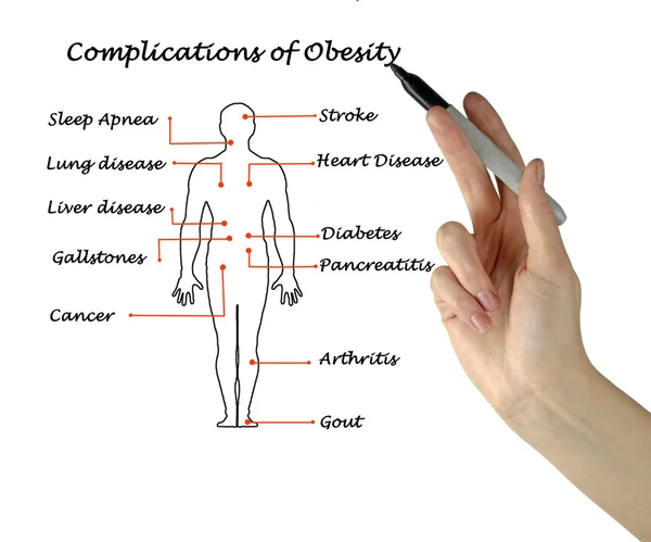 Complicaties van obesitas — Stockfoto